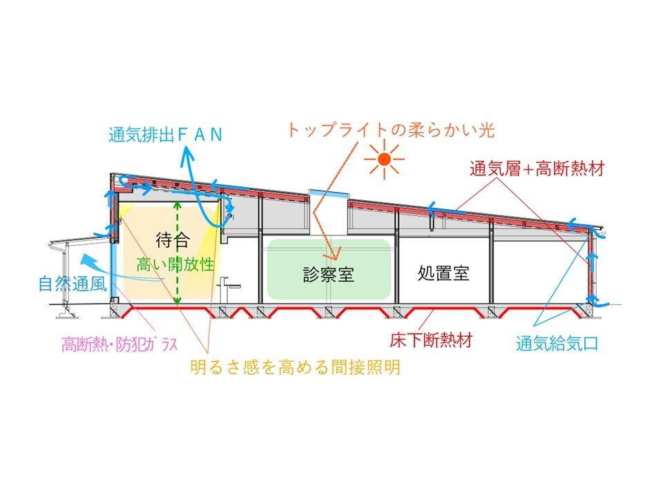 断面図_medoc